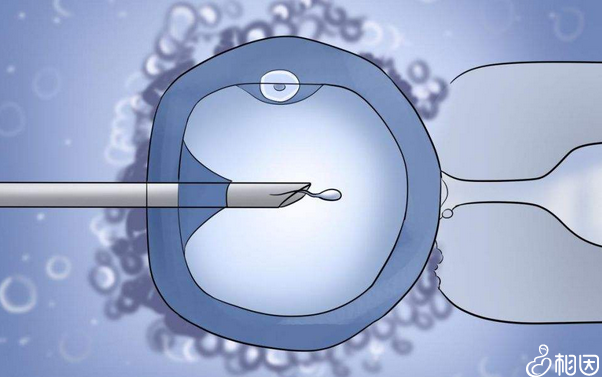 试管婴儿技术单周期费用分析