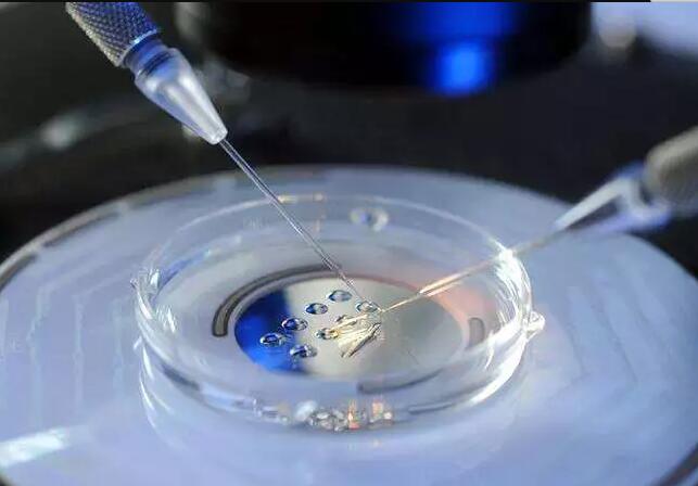 试管婴儿手术费用评估