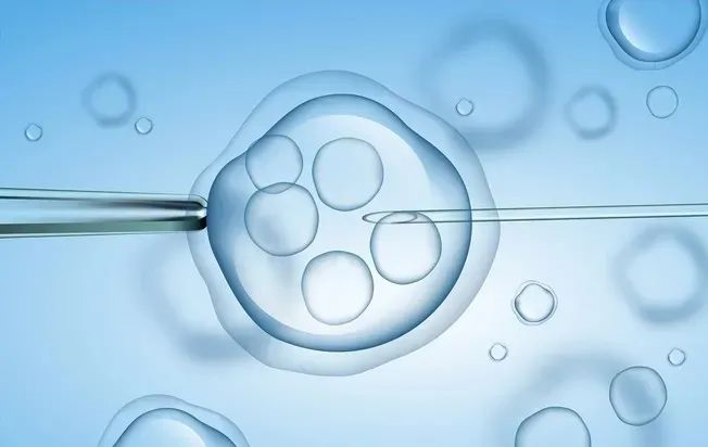 试管婴儿技术中染色体筛查的应用研究