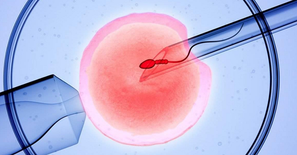 试管婴儿技术中男方因素的分析与解决策略